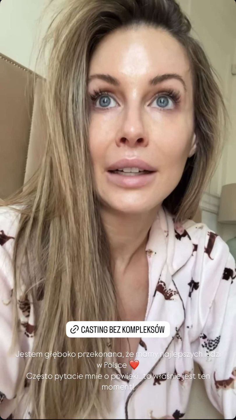 Małgorzata Rozenek prezentuje "naturalne" oblicze z rana