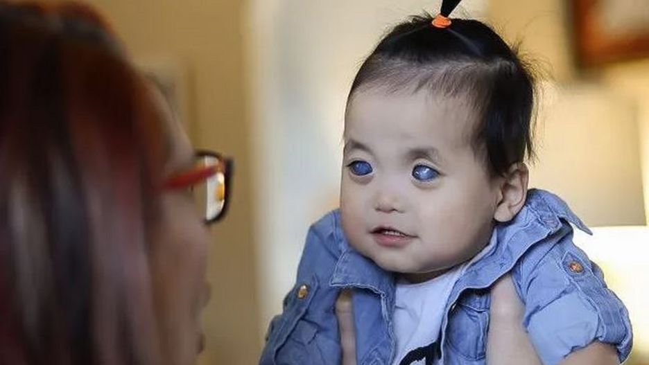 Tuż po narodzinach porzuciła ją matka. "Dziewczynka o srebrnych oczach" znalazła kochający dom