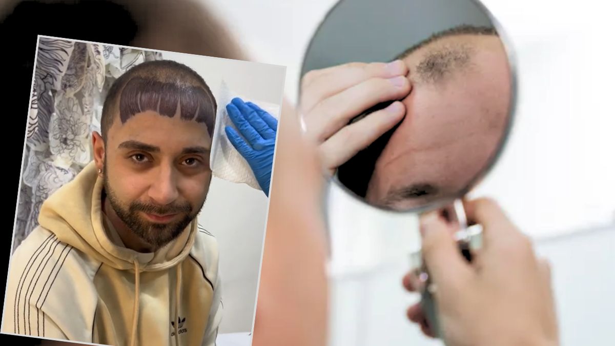 Mężczyzna z wytatuowaną grzywką na łysinie