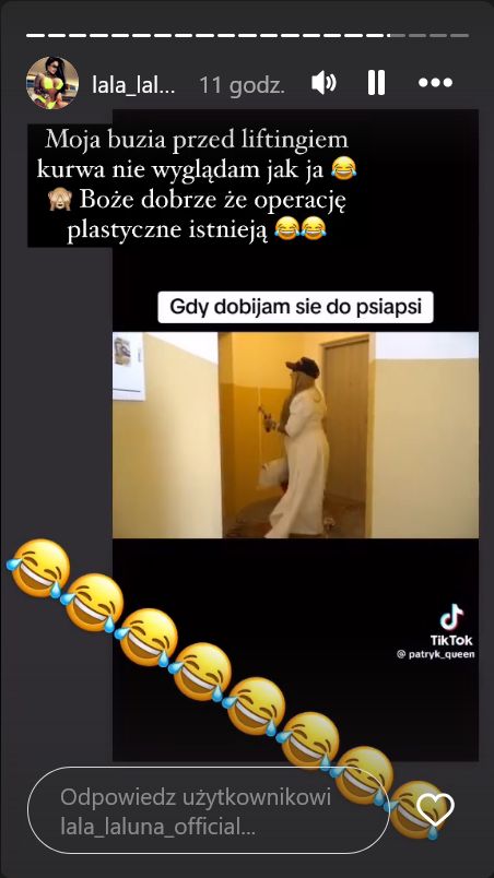 Laluna pokazała twarz przed liftingiem