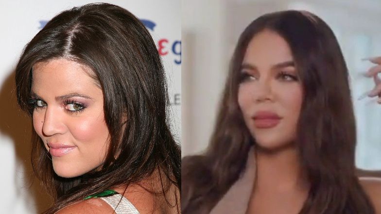 Khloe Kardashian i jej zmieniająca się twarz odpowiadają na złośliwy komentarz internautki. "Po operacjach WYGLĄDASZ JAK KOSMITKA"