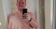 Casey King był tak otyły, że nie mógł się umyć. Seks był abstrakcją