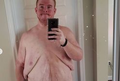 Casey King był tak otyły, że nie mógł się umyć. Seks był abstrakcją