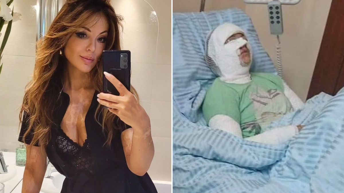 Dramatyczna historia Polki. W sądzie została zaatakowana kwasem.