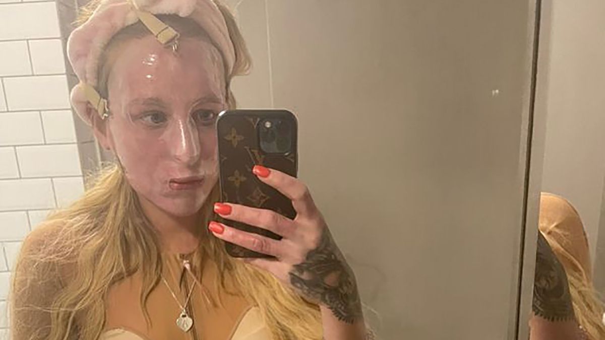 28-letnia April Charlesworth dzieli się swoim procesem powrotu do zdrowia w mediach społecznościowych