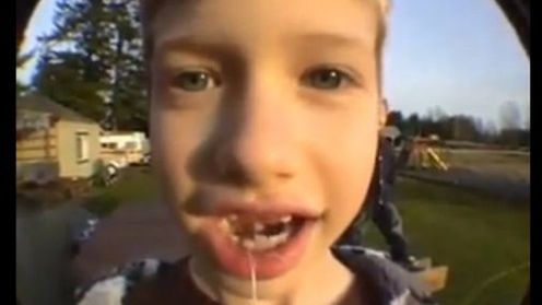 Jak przy pomocy rakiety usunąć dziecku ząb? (wideo) 1