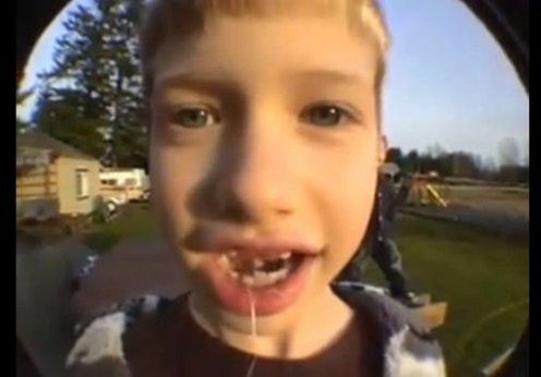 Jak przy pomocy rakiety usunąć dziecku ząb? (wideo)