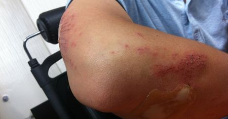 Uczestnik Strajku Kobiet został brutalnie pobity. Pokazał obrażenia