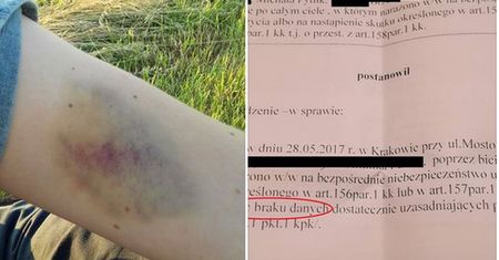 Pobili ich, bo rozmawiali o gejach. Policja umorzyła śledztwo z "braku danych"