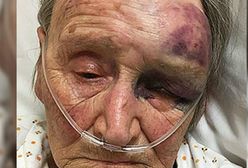 Wyciągnął 88-latkę z łóżka i brutalnie pobił. W szoku byli nawet policjanci