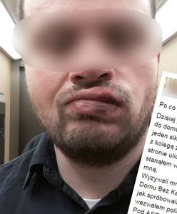 Wyzywali go od pedałów i pobili. Patrol wezwany do interwencji... minął się z poszkodowanym