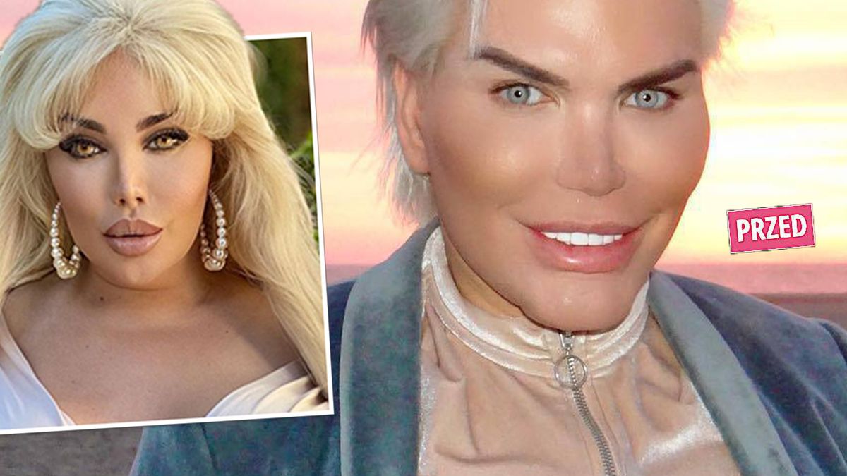 Żywy Ken zmienił się w żywą Barbie i eksponuje w social mediach monstrualnych rozmiarów biust. Posunął się o krok za daleko?