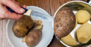 Surowe ziemniaki mogą zdziałać cuda. Twoja cera będzie uratowana