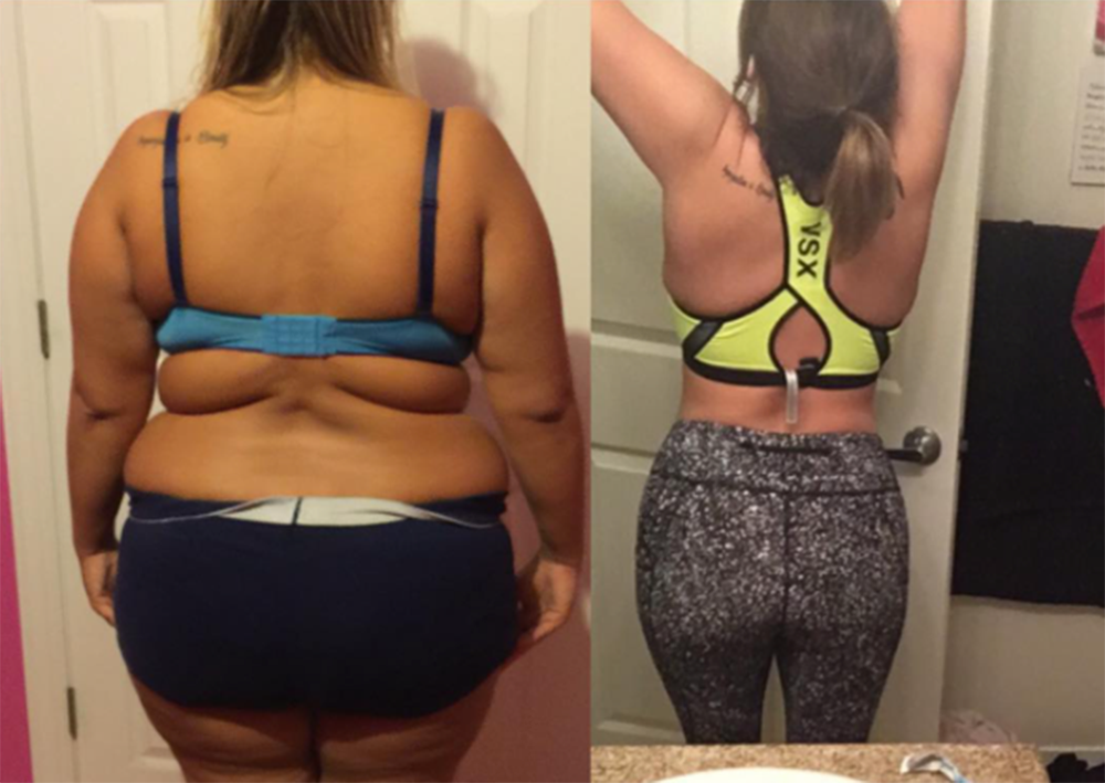 Usłyszała, że marnuje piękną twarz otyłością. Zrzuciła 50kg