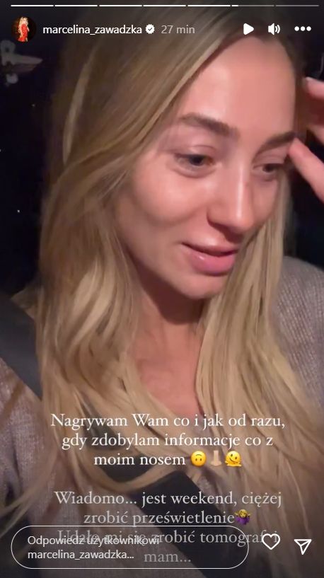 Marcelina Zawadzka miała wypadek. Co się stało? (fot. InstaStories)