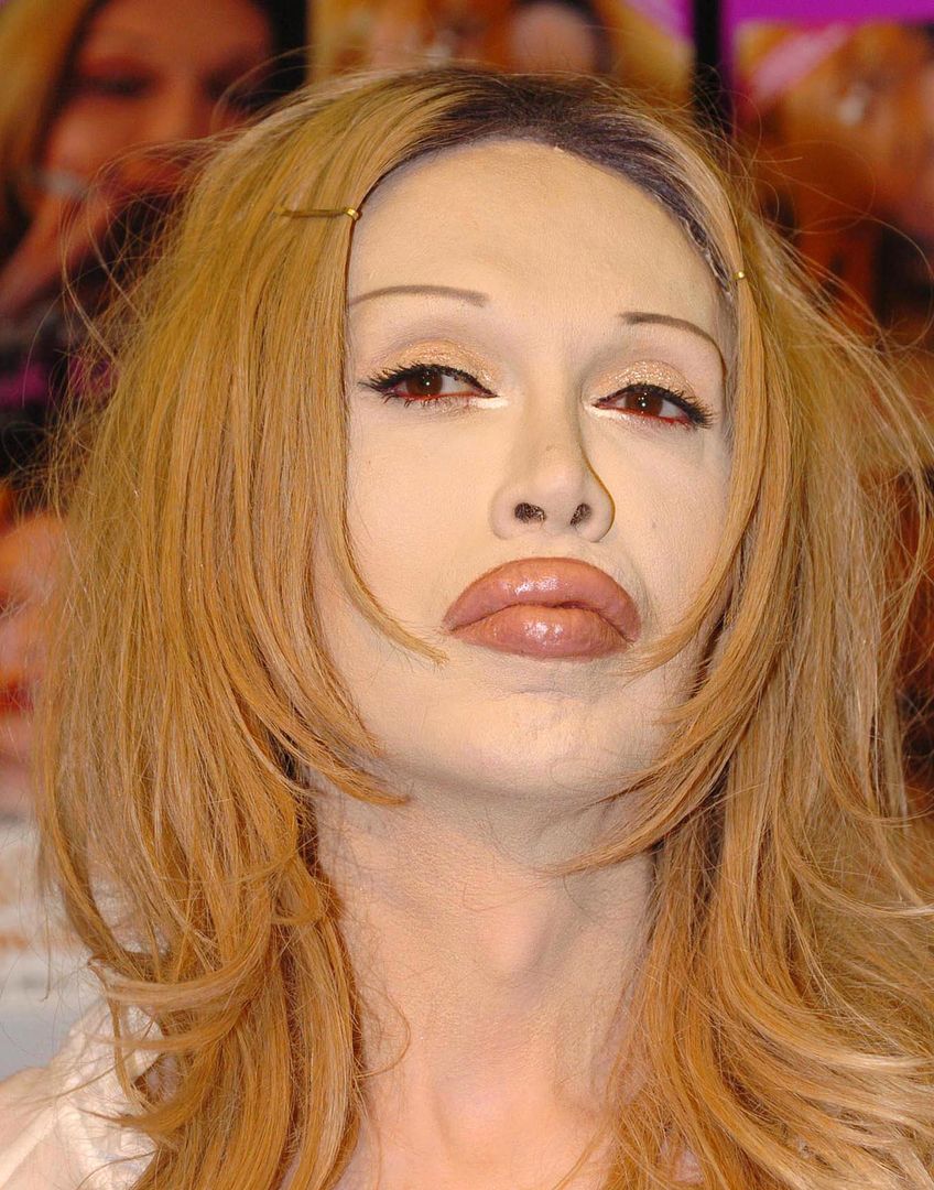 Pete Burns