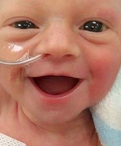 "Cieszy się, że żyje". Tak dziś wygląda najsłynniejszy wcześniak świata