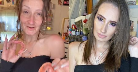 "Bezzębna Księżniczka" zachwyca na TikToku! Po ciążach straciła wszystkie zęby i przeszła spektakularną metamorfozę (FOTO)