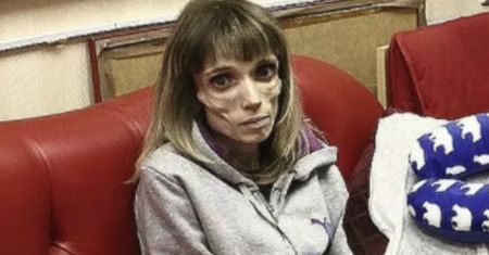 Kiedyś ważyła 17 kg i nie mogła sama wstać z łóżka. Tak wygląda dziś