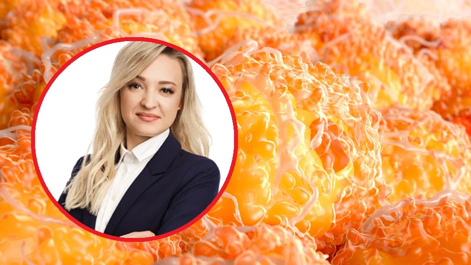 Stany zapalny może negatywnie wpływać na naszą długość życia.