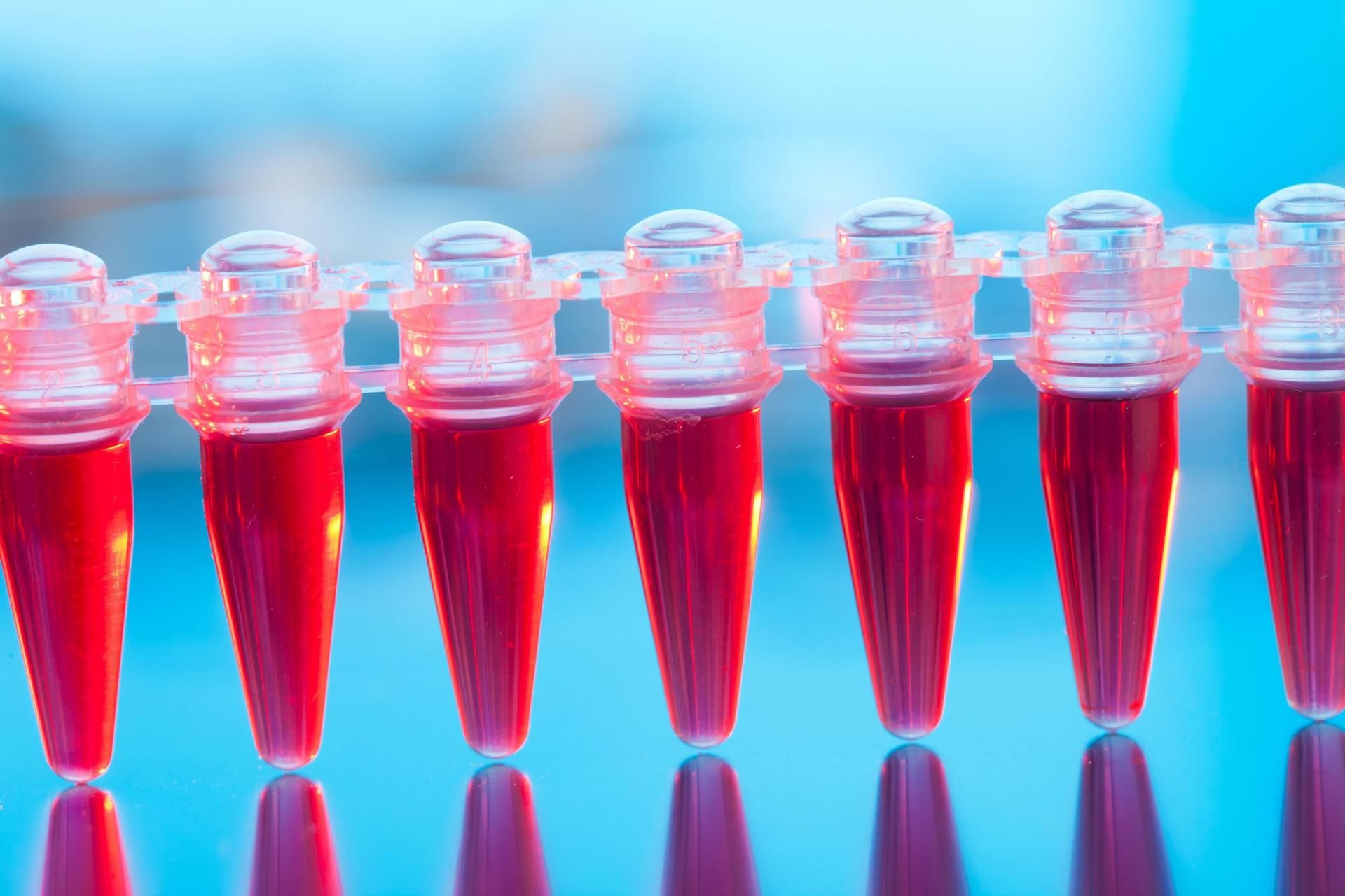 Niski poziom hemoglobiny jest przykładowo objawem niedoboru żelaza