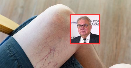 Sprawca zakrzepów i miażdżycy. "Tzw. serce żylne przestaje pracować"