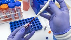 Grupa krwi a ryzyko raka trzustki. Te osoby są najbardziej narażone