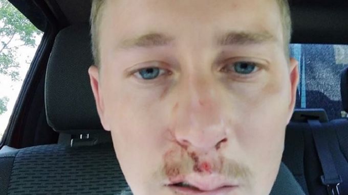 Napił się zimnej wody i stracił przytomność