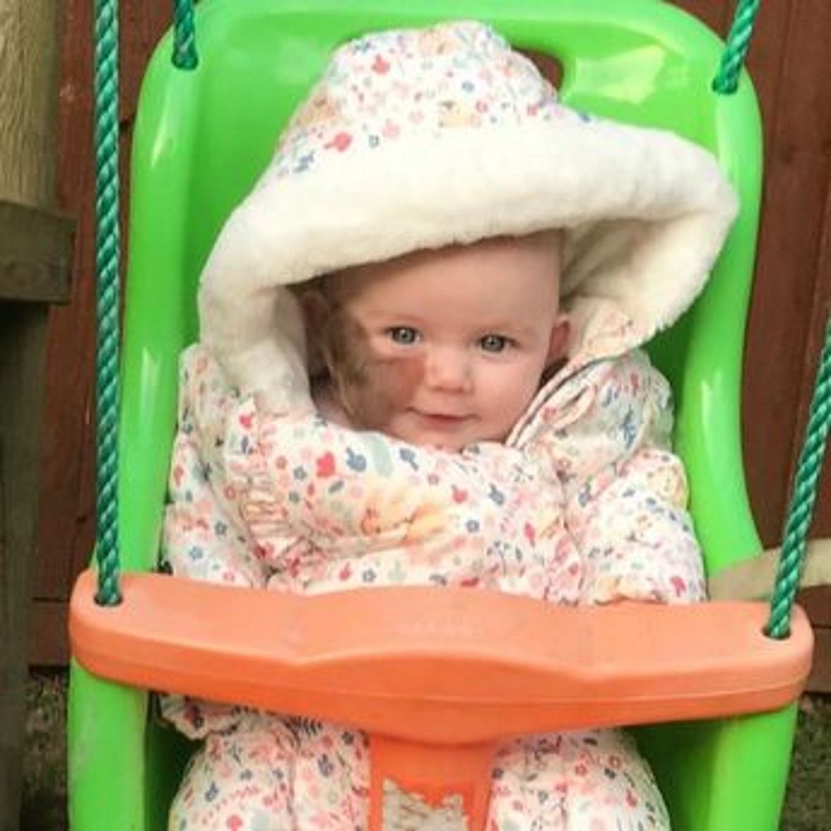 Dziewczynka urodziła się z 