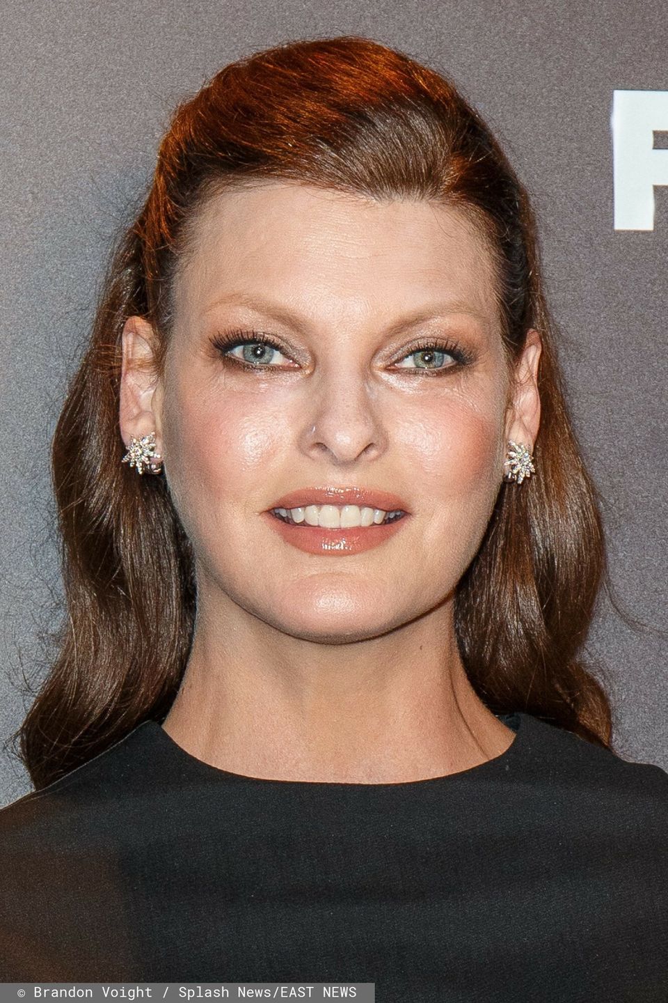 Linda Evangelista o nieudanym zabiegu
