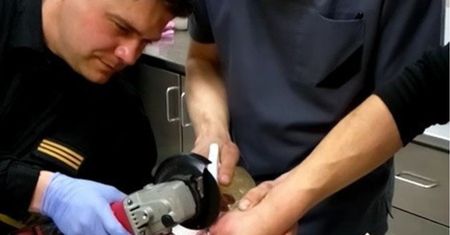 Założył na palec i zasnął. Nawet na SOR-ze nie mogli mu pomóc