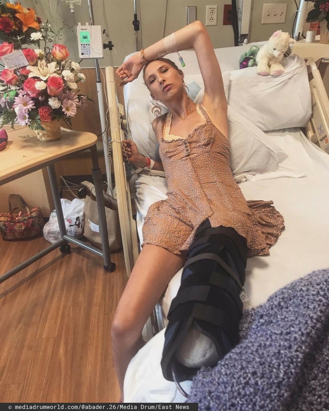Lexi Bader po pierwszej amputacji
