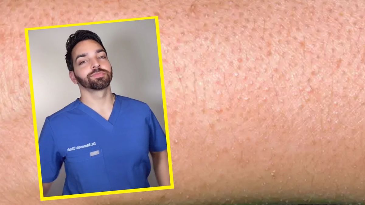 Dermatolog zabrał głos