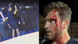 Gwiazdor "Słodkich kłamstewek" został napadnięty z BRONIĄ w ręku. Wszystko zarejestrowały kamery (WIDEO)