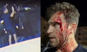 Gwiazdor "Słodkich kłamstewek" został napadnięty z BRONIĄ w ręku. Wszystko zarejestrowały kamery (WIDEO)