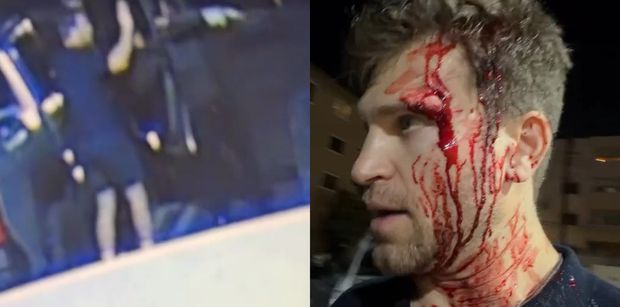 Gwiazdor "Słodkich kłamstewek" został napadnięty z BRONIĄ w ręku. Wszystko zarejestrowały kamery (WIDEO)