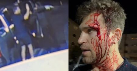 Gwiazdor "Słodkich kłamstewek" został napadnięty z BRONIĄ w ręku. Wszystko zarejestrowały kamery (WIDEO)