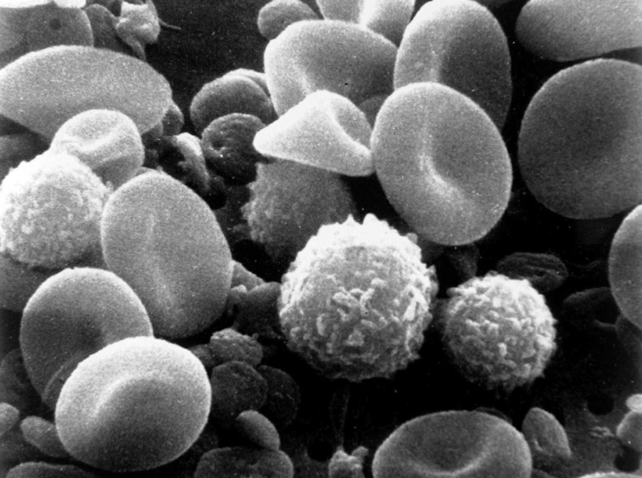 Limfocyty mordują wroga w megapowiększeniu [wideo]