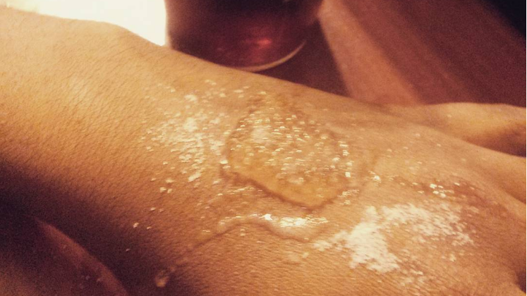 Salt and ice challenge jest popularne w Wielkiej Brytanii 
