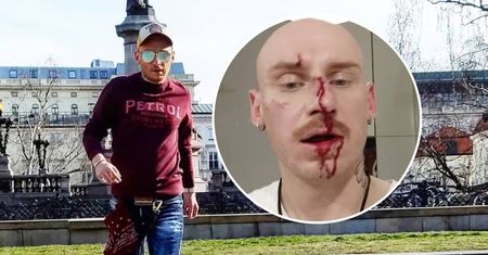 Jacek Szawioła pobity. Uczestnik "Gogglebox" wydał oświadczenie