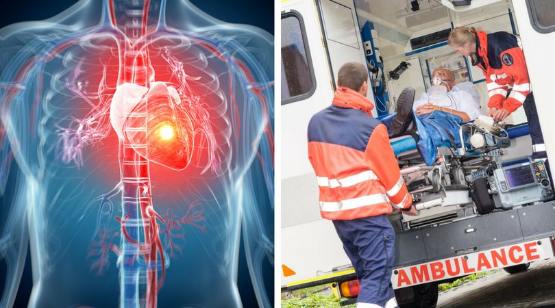 7 rzeczy, które mogą zwiększać prawdopodobieństwo ataku serca