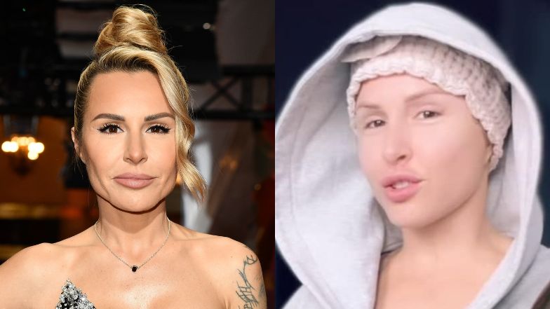 Blanka Lipińska pokazała się po liftingu twarzy
