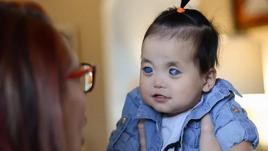 Jak dziś wygląda dziewczynka o srebrnych oczach?