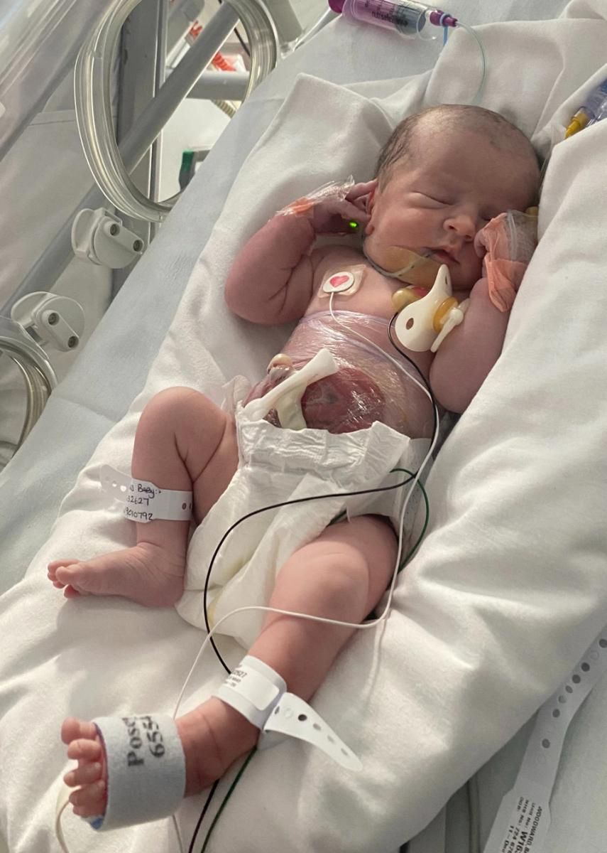 Millie miała jelita owinięte folią