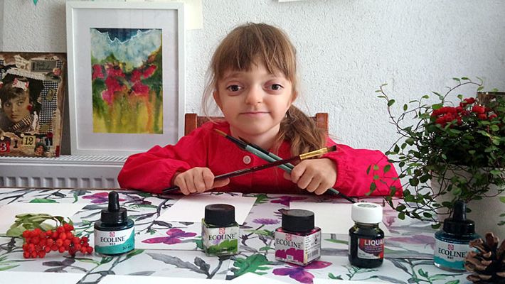 Lena Mazurek cierpi na Zespół Crouzona