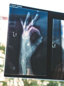 Prawie 2 miliony złotych za STAREGO MEMA? Hit sprzedany jako NFT