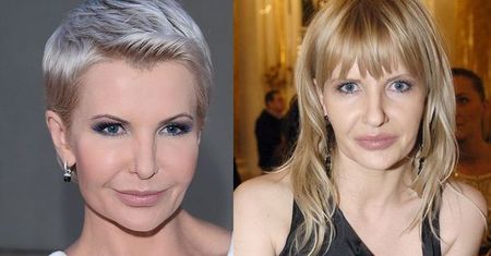 Joanna Racewicz: jej twarz ewoluuje!