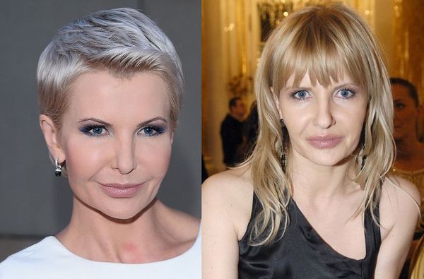 Joanna Racewicz: jej twarz ewoluuje!