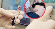 Przełomowy test krwi. Umożliwi wczesne wykrycie raka trzustki