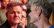 Gordon Ramsay poinformował, że zdiagnozowano u niego RAKA SKÓRY. Kucharz miał zabieg: "Obiecuję, że to nie LIFTING"